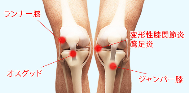 膝の怪我 L 武蔵境中央整骨院